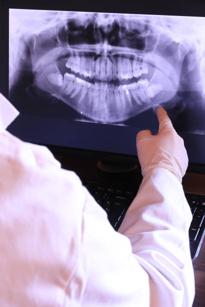 Best Emergency Broken Tooth Repair in Princeton, MO